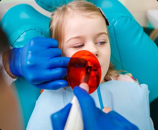 Dental Sealants