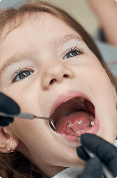 A child receiving a dental crown at Big Picture Pediatric Dentistry