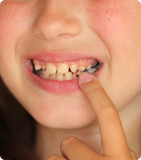 Young child smiling and showing healthy teeth